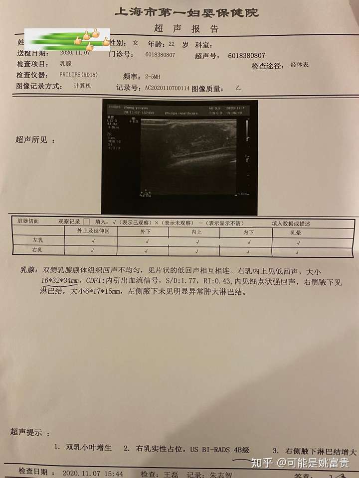 乳腺彩超4b翻盤上海第一婦嬰保健院乳腺手術纖維瘤乳腺腫瘤婦科全面大