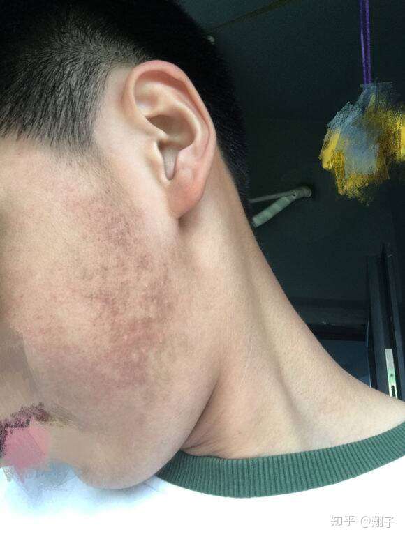 有鸡皮肤的你能忍吗?