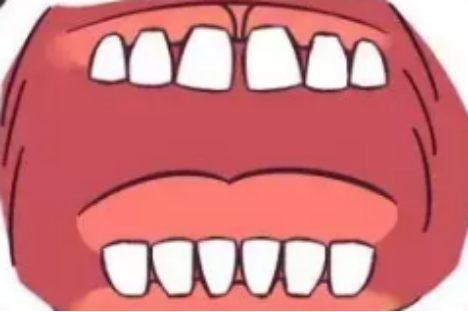 孩子的牙缝大或者小需要矫正嘛