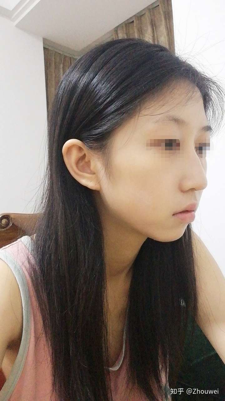 侧面巨丑正面好看是一种什么感受?