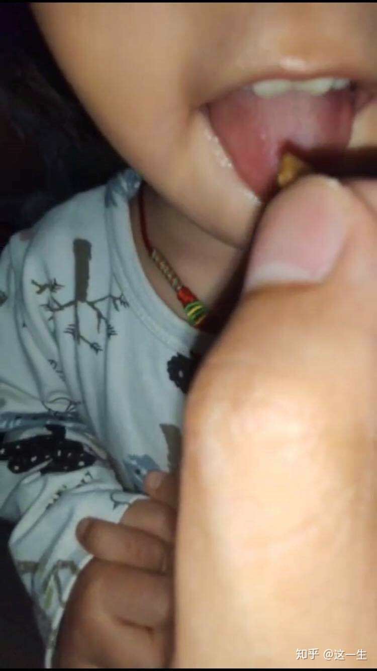 舌苔厚白知乎