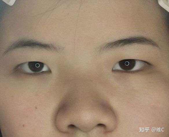 这是正常情况下,哪天没睡好眼睛会更肿