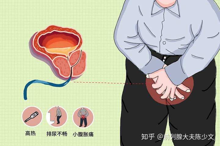 前列腺炎疼痛位置图片