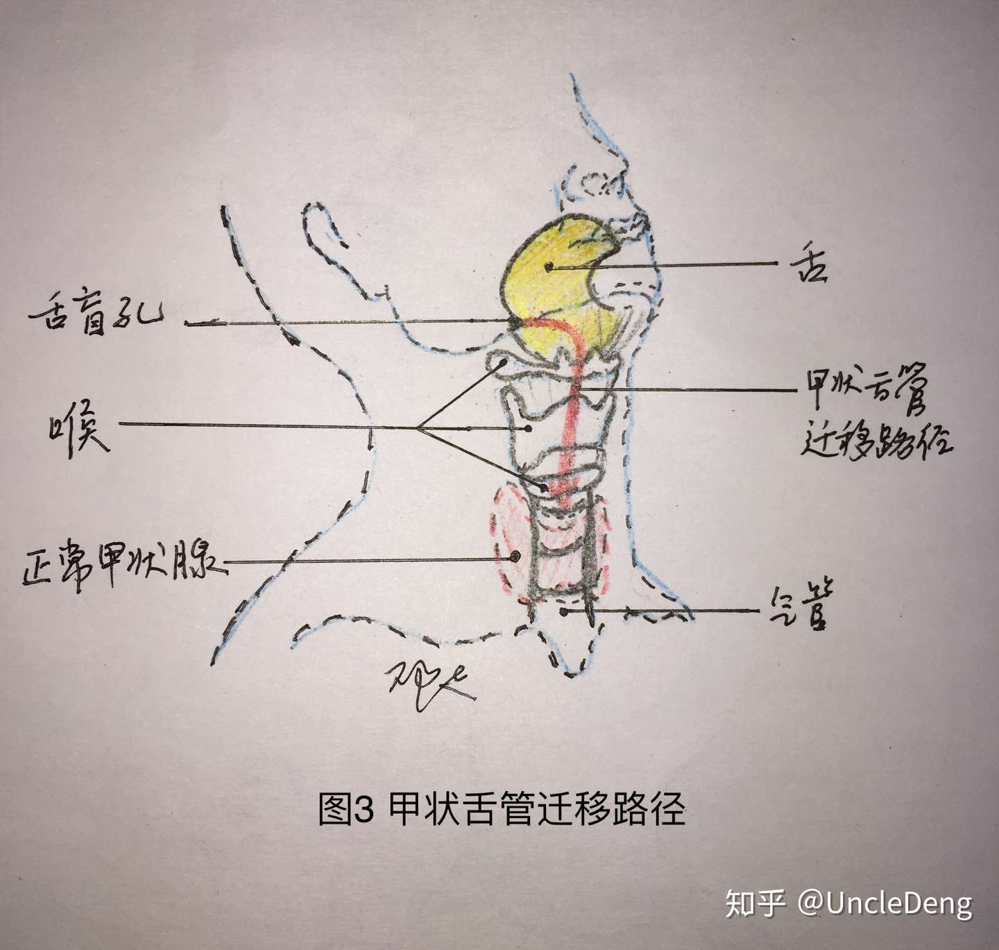 什么 甲状腺还能 长错地方 知乎