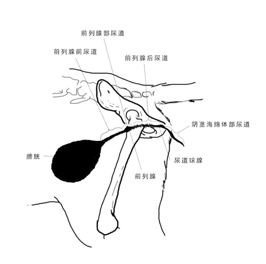 尿不出来就要做手术吗 谈谈尿道造口术 知乎