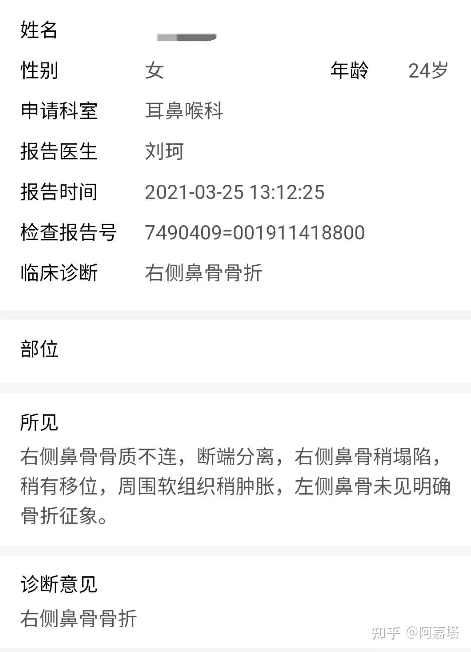 鼻骨骨折复位手术经历分享 知乎