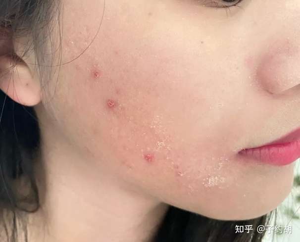 熬夜对外貌的影响有多大?