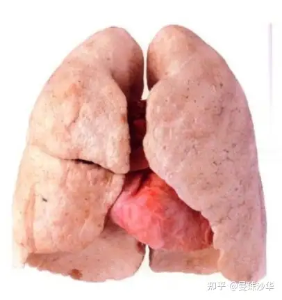 从第一根烟到抽了五年