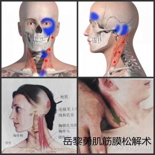 前额疼痛怎么解决 胸锁乳突肌肌筋膜疼痛触发点轻松帮你解决 知乎