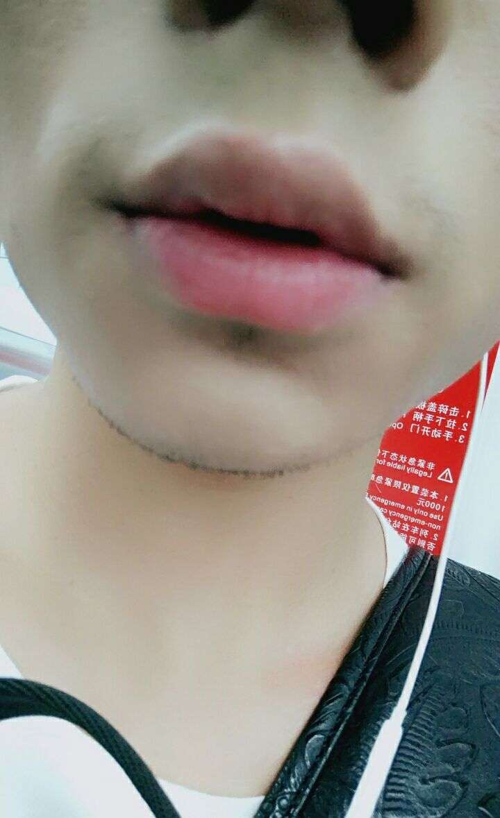 嘴唇厚一直很自卑,有些人觉得嘴唇厚性感,可是真的不好看,总之我不能