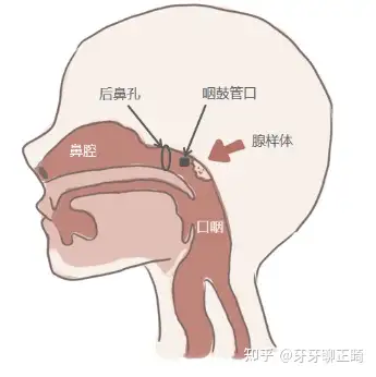 增殖體)為一群淋巴組織,位於咽穹後部,附著於鼻咽的頂壁和後壁交界處