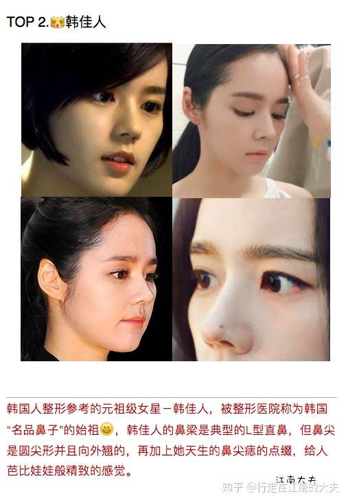 韩国整形医院参考的女艺人鼻模版 最受韩国人喜欢的韩女星鼻子 隆鼻模版 知乎