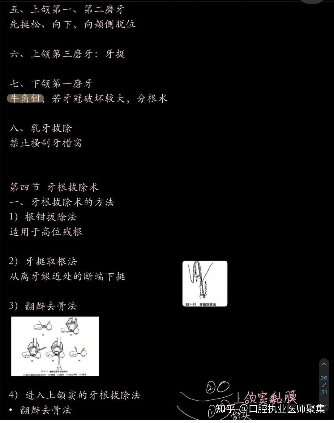 22口腔执业 助理 医师口外第2 3单元考点总结 知乎 22口腔执业 助理 医师口外第2 3单元考点总结 知乎