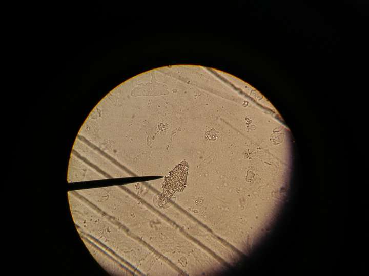 大家都考完了在那聊天休息,我找到了这个,问老师是不是蠕形螨的虫卵