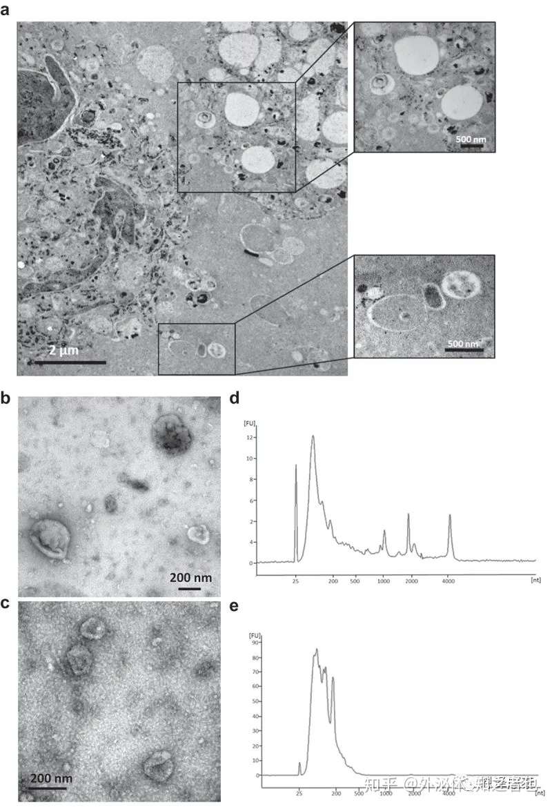 组织外泌体的提取方法和研究应用 知乎