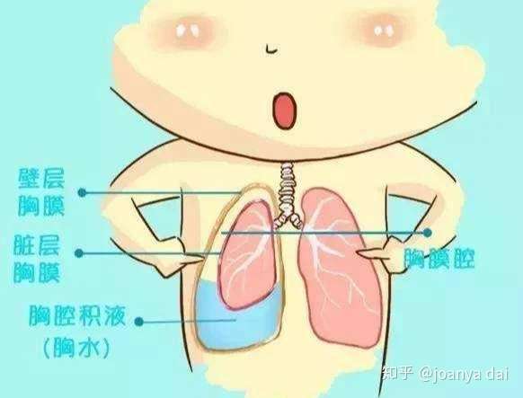 中山大学医学博士 某些症状和某些检测的结果可能显示一个人患有肺癌