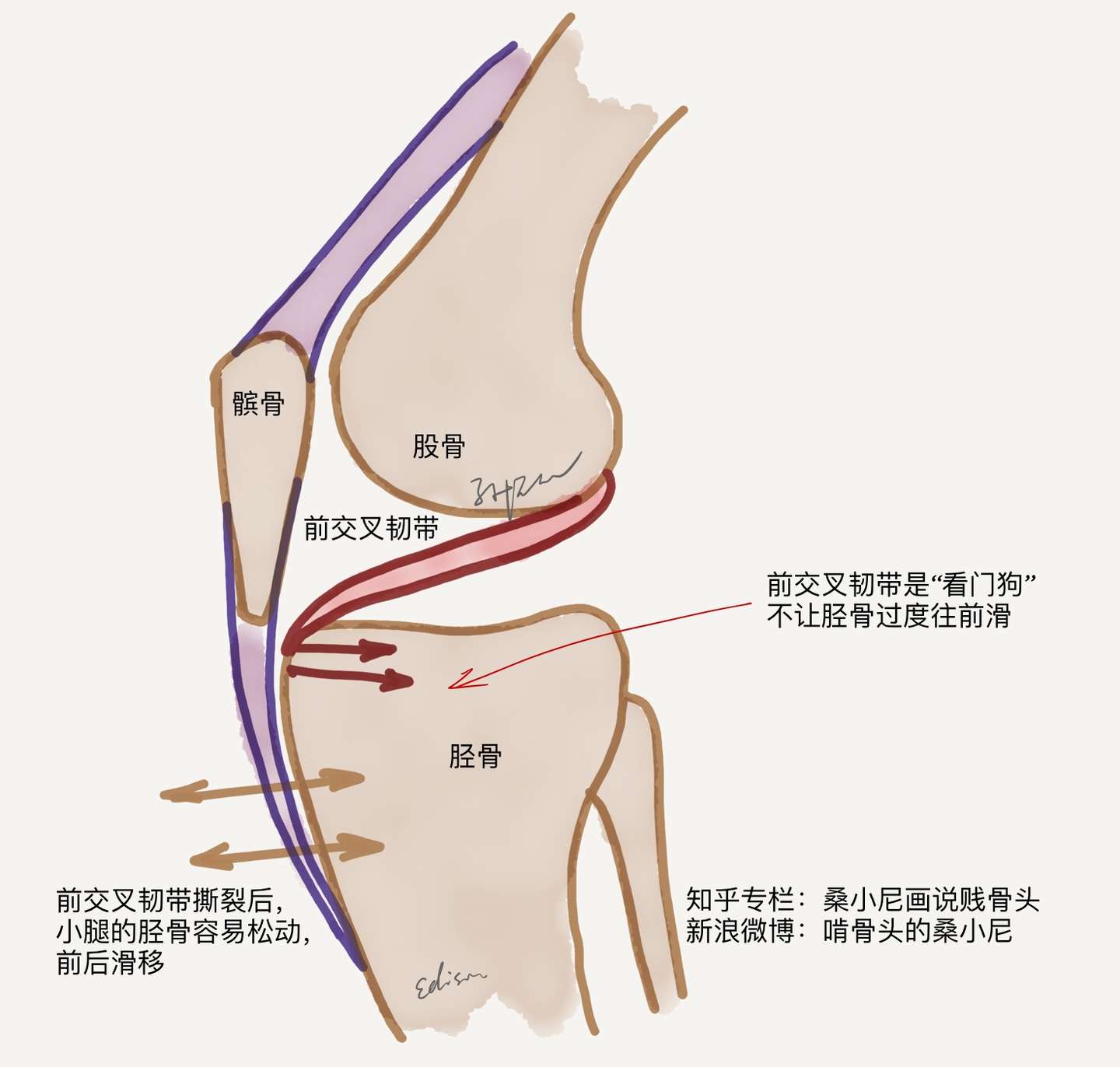 十字韧带撕裂后 罗斯还能回到巅峰吗 知乎