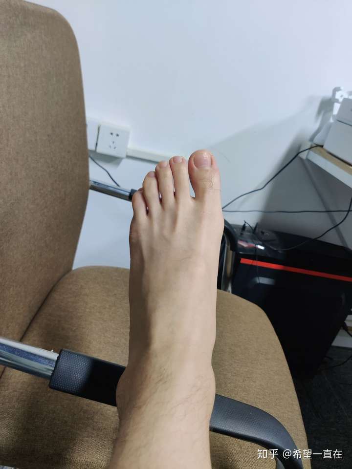 我这样的脚可以做足模吗?