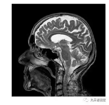 算法集锦(5)|医学图像的边缘检测|Python_边缘检测方法分割医学图像图-CSDN博客