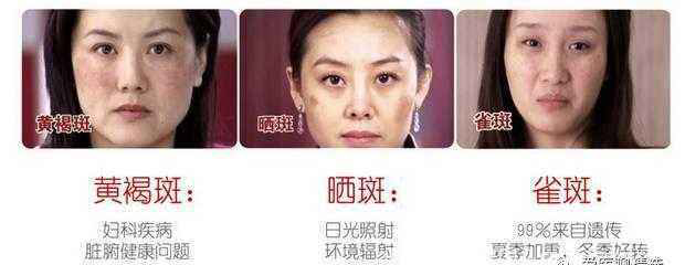 医美的效果强大到真的会上瘾(图39) 医美的效果强大到真的会上瘾(图42)