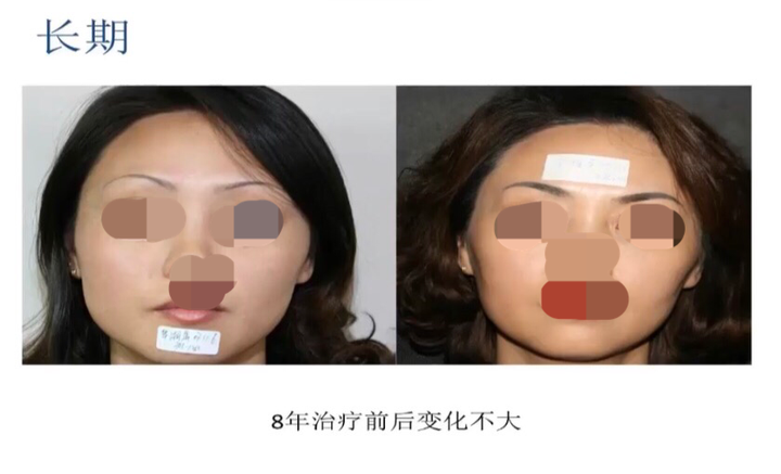 医美的效果强大到真的会上瘾(图44) 医美的效果强大到真的会上瘾(图50)