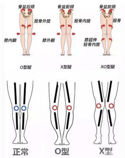 膝关节稳定性 