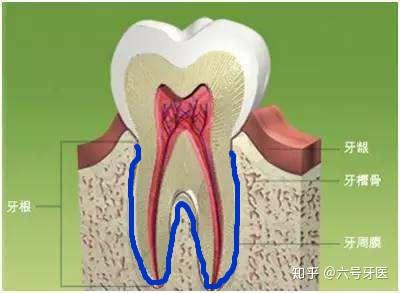 为什么牙龈萎缩,牙槽骨吸收不可逆?