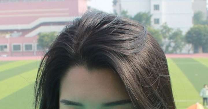 有美人尖并且旁边有个旋