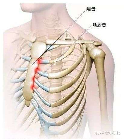 胸痛 左侧肋骨疼痛的看过来 知乎
