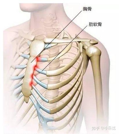 胸痛左侧肋骨疼痛的看过来