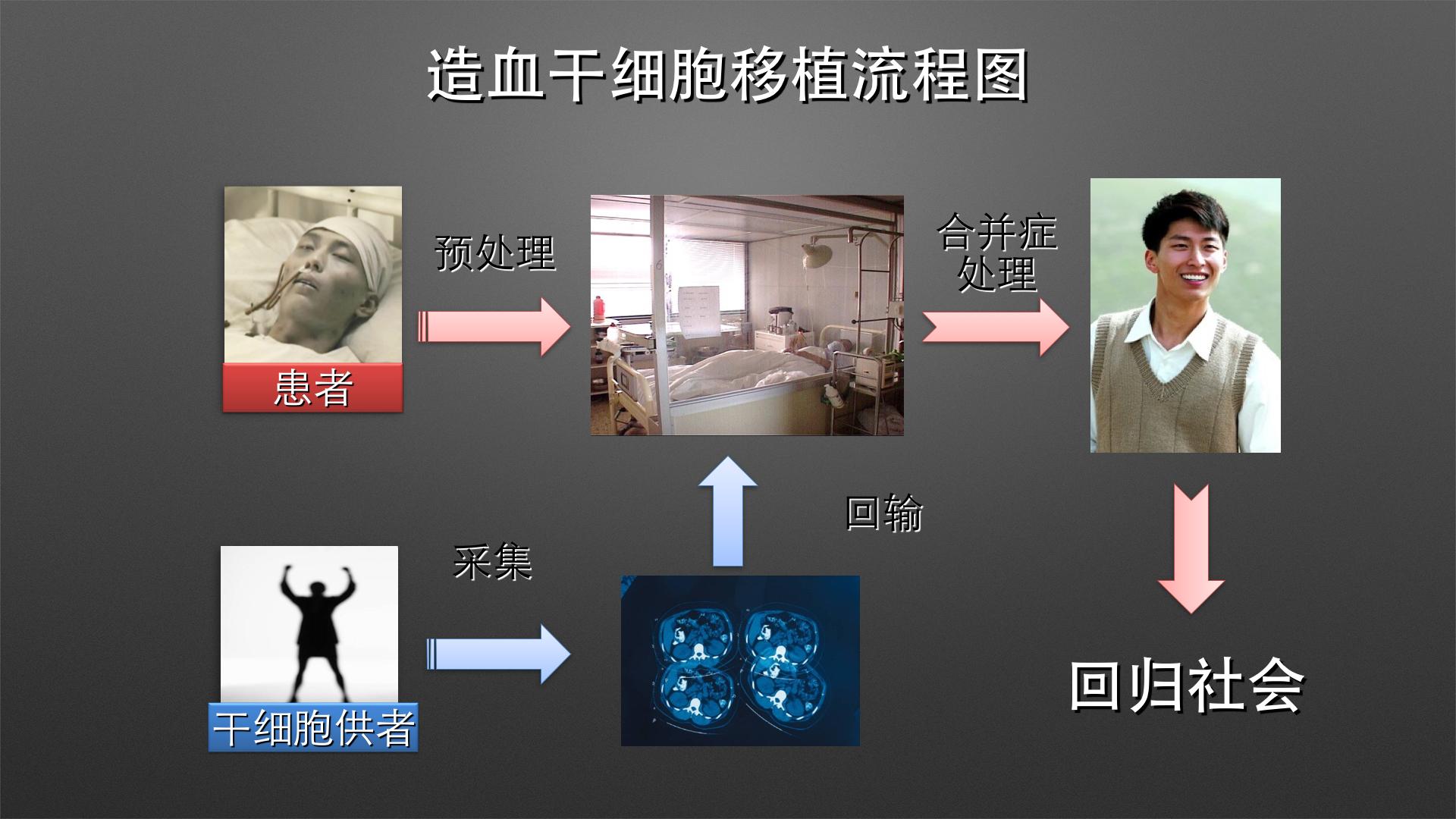 移植治疗的原理,就是将正常人的造血干细胞通过采集(一般包括骨髓或