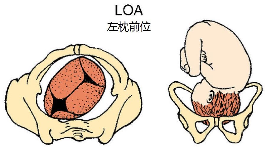 另外,布鲁特斯空军基地实验室的previc还认为,惯用手与胎儿在母体时