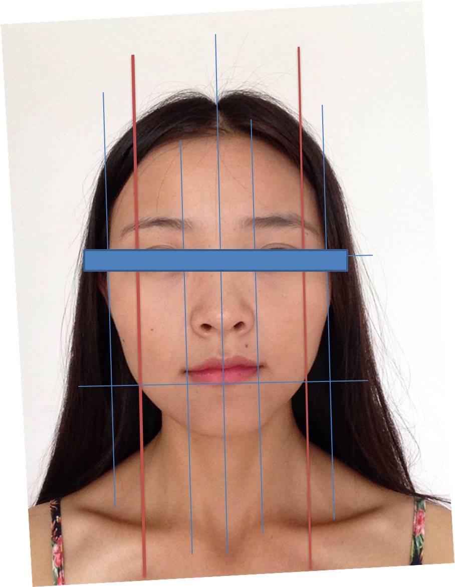 我的左边下巴打哈欠的时候会响,脸型不对称,笑