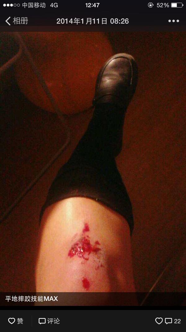 腿上伤疤流血图片图片