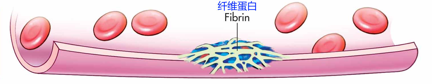 皮肤破后,流血结痂愈合是一个怎样的过程? - 知乎