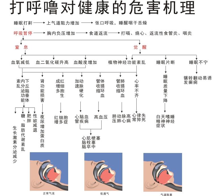 打呼噜到底是病么,为什么很少有人因为打呼噜