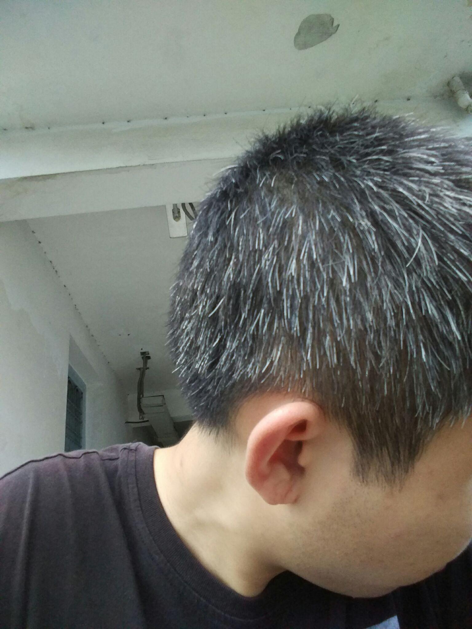 有少白头是怎样一种经历?