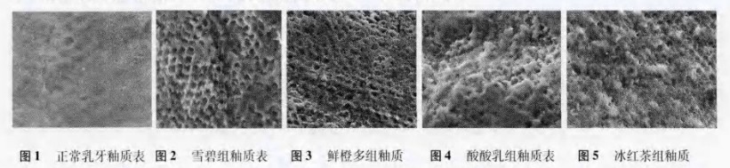 (转)谁能想到,饮料正在“谋杀”我们的牙齿 (转)谁能想到,饮料正在“谋杀”我们的牙齿