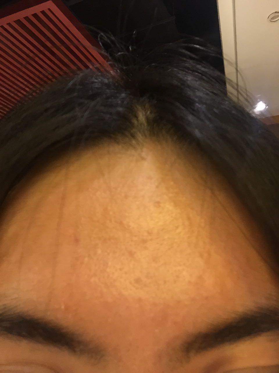 敏感肌…脸颊干各种脱皮额头闭口痒刺痛？ - 花吃了那兽的回答- 知乎