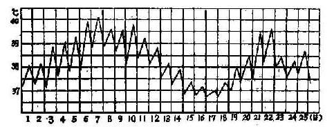 而波状热的加强版,是为佩-埃热(pel-ebstein fever),这种热型专属于