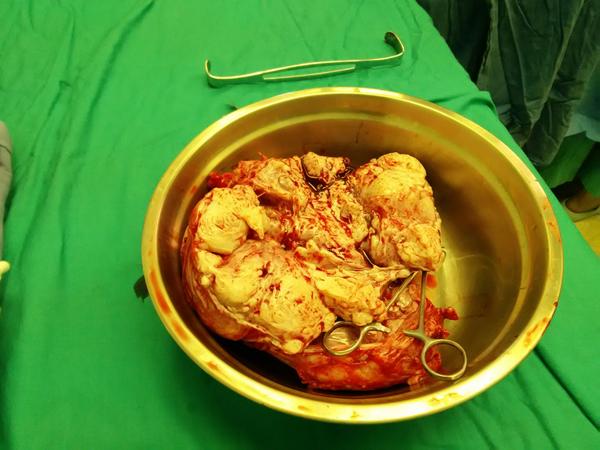 癌细胞可以无限增殖,可不可以作为食物培养?