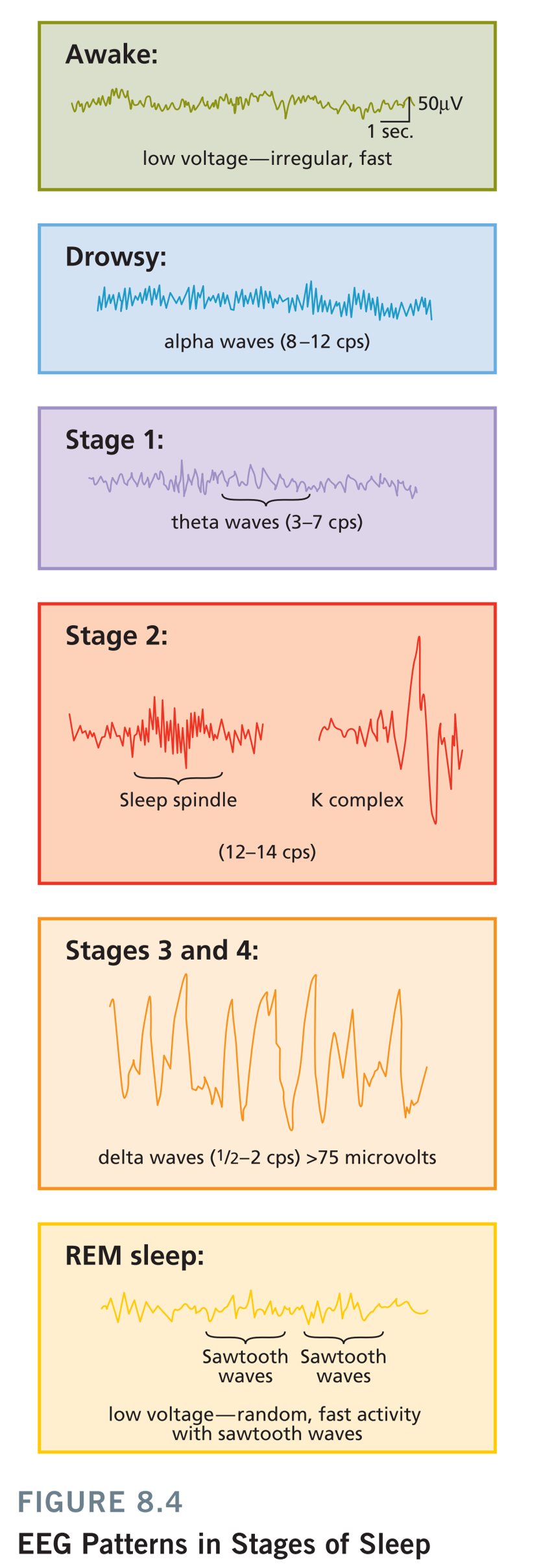 四阶段的特征如下: stage1,脑电从清醒状态的alpha波转为theta波,这个