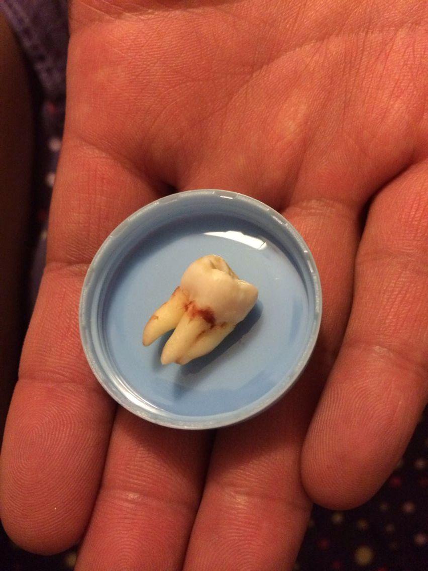 拔牙会上瘾,被拔牙也会上瘾.