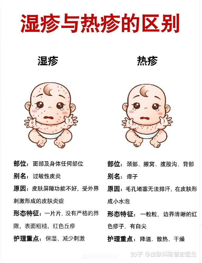干货 ️湿疹与热疹的区别及护理方法 - 知乎