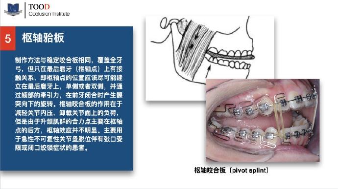 對於保守復位法,不一定百分百復位,急性不可復關節盤移位的保守復位法