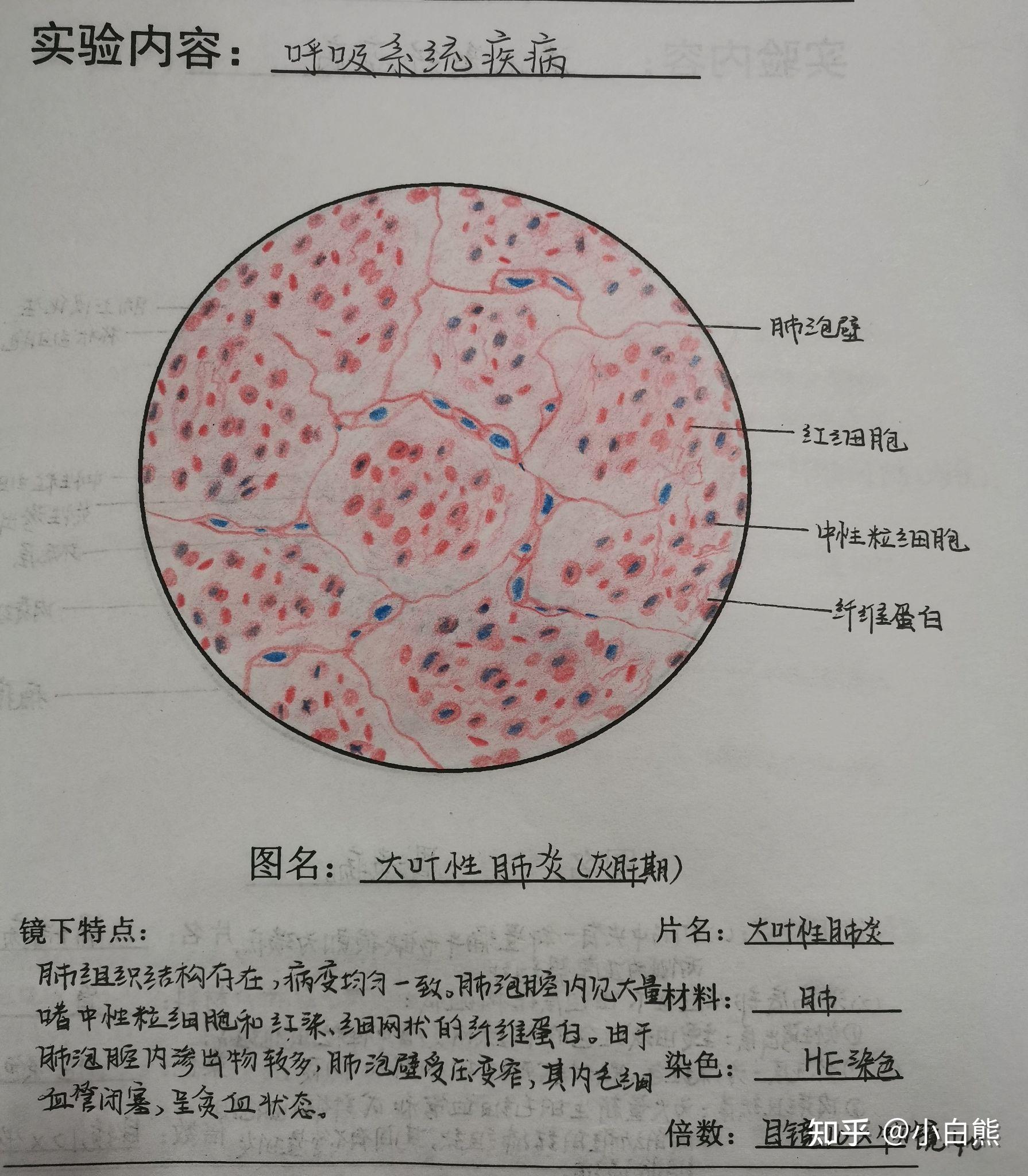 病理学实验红蓝铅笔绘图