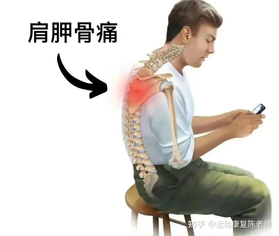 后背、肩胛骨区域疼痛是怎么回事？该如何应对？告诉您 - 知乎