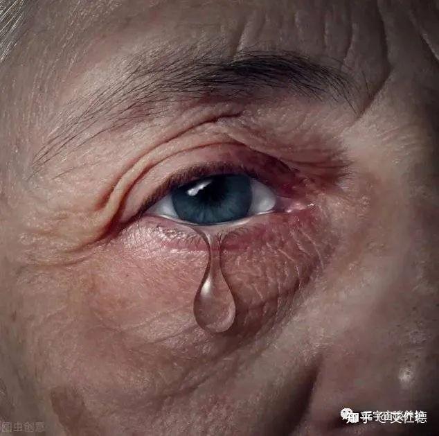 亮眼灸——关于迎风流泪那点事儿 - 知乎