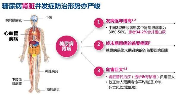 糖尿病肾病症状 (糖尿病肾病症状有哪些会不会腰酸)