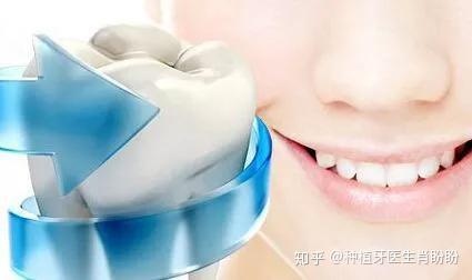 什么人不适合做牙齿贴片 v2-00aef0ccf2c619c5b2b8000303ccf99f_r.jpg
